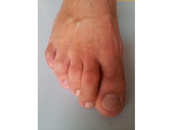 Bild 10 von Porkristl Orthopädieschuhmacher & Podologe