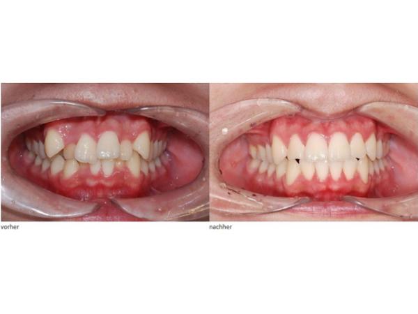 Bild 1 von ts-dent - esthetic dental technology