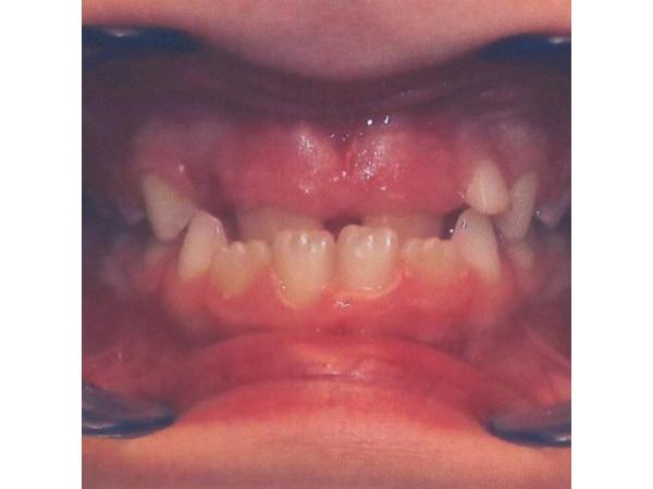 Bild 7 von Ganzheitliche Zahnmedizin und Kieferorthopädie Prof. DDr. Irmgard Simma