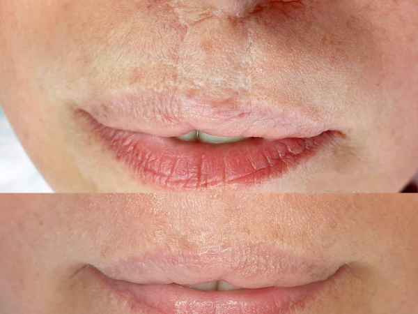 Bild 16 von Permanent Make up Wien JUSTYNA WACHEK
