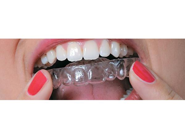 Bild 2 von ts-dent - esthetic dental technology