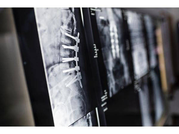 Bild 3 von Radiologie Graz-St. Peter, Dr. Thimary - Dr. Marterer