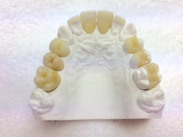 Bild 3 von Dentalstudio D&W Zahntechnik OG
