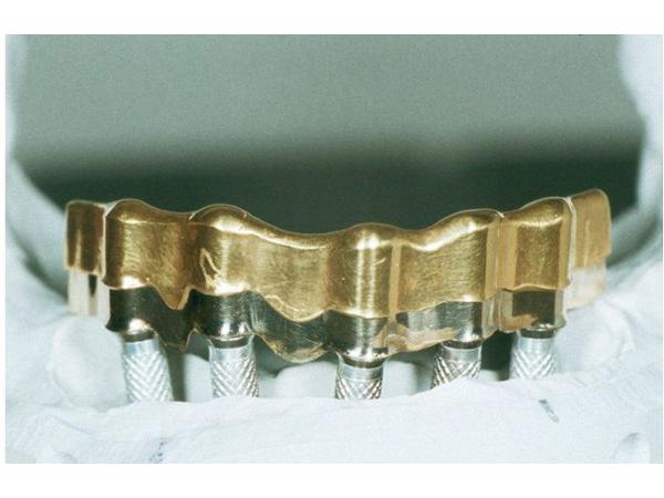 Bild 3 von Fischer Dental - Technik GesmbH & Co KG