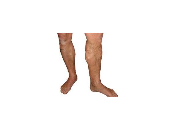 Bild 2 von Venesthetic® by Dr. Edgar Raschenberger