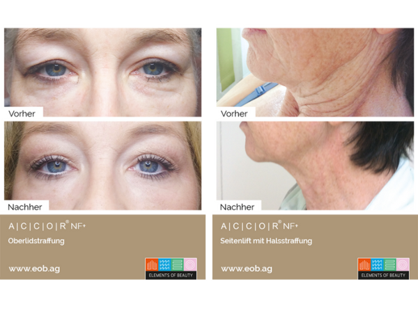 Bild 3 von Donella formt - Apparative Kosmetik