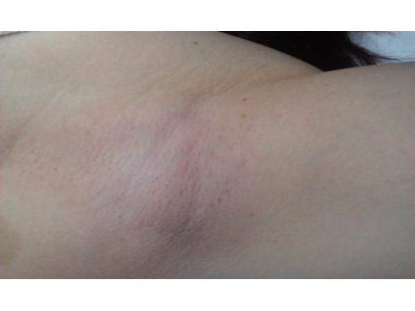 Bild 1 von Sugaring by Anita Inh Anita Patz