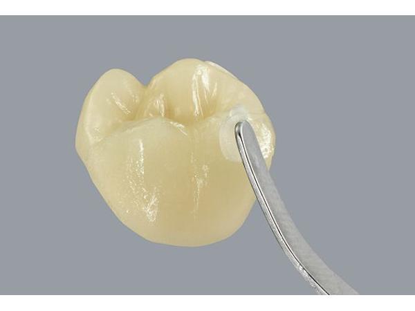 Bild 7 von Fischer Dental - Technik GesmbH & Co KG