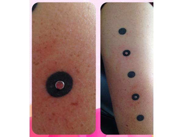 Bild 6 von Piercingambulanz - Kathi Hart