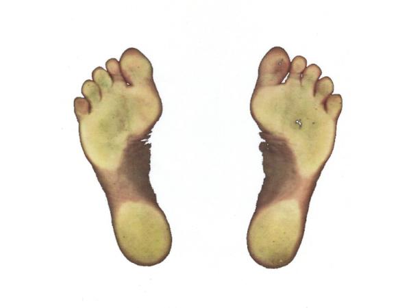 Bild 7 von Porkristl Orthopädieschuhmacher & Podologe
