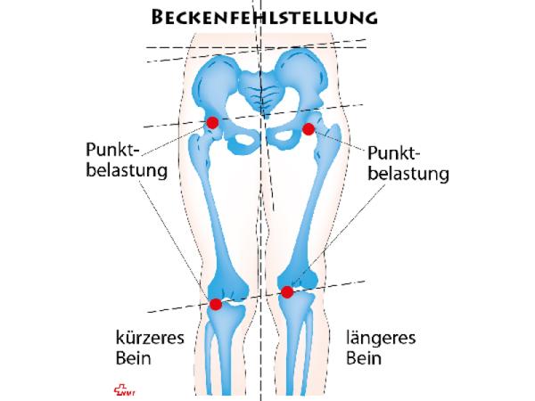 Bild 16 von Peter Grasser, Blutegeltherapie, Schmerztherapie