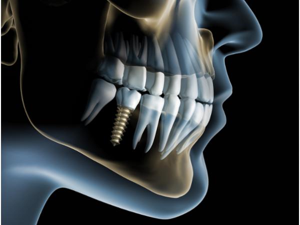 Bild 4 von Dental Spa - Whitelounge