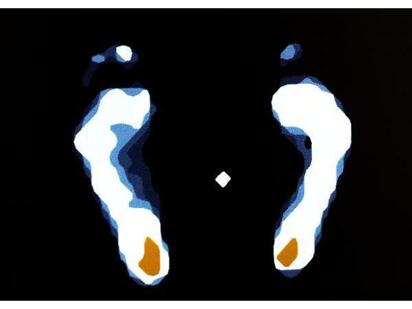 Bild 39 von Orthopädieschuhtechnik Wild-Schlögl KG