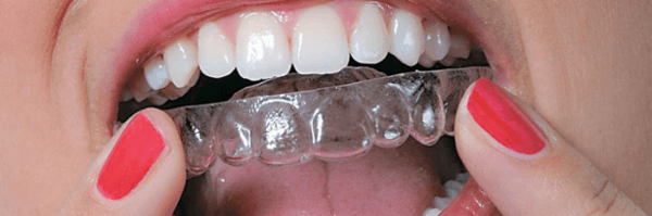 Vorschau - Foto 3 von ts-dent - esthetic dental technology