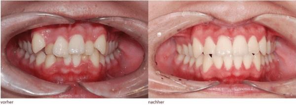 Vorschau - Foto 1 von ts-dent - esthetic dental technology