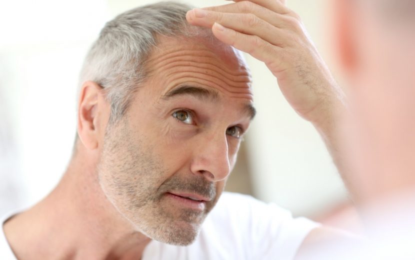 Haartransplantation Wien, Methode, Haare