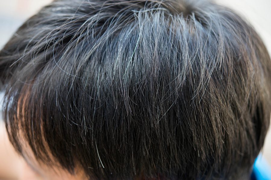 Graue Haare