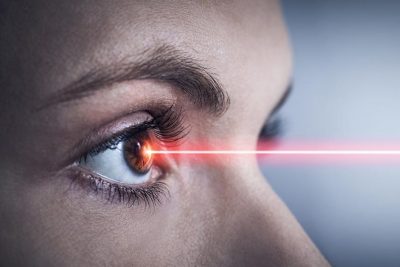 Augen lasern Erfahrungsbericht