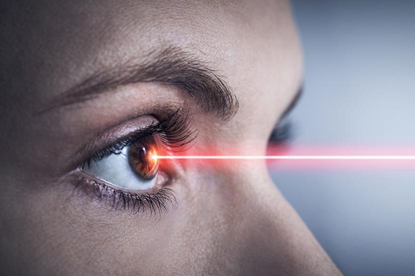 Augen lasern Erfahrungsbericht