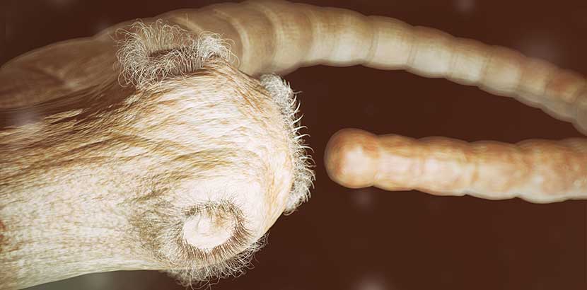 Bandwurm im menschlichen Darm. Wie bekommt man Bandwürmer?