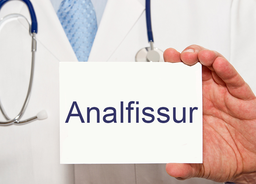 Analfissur heilen Therapie mit und ohne OP HEROLD.at
