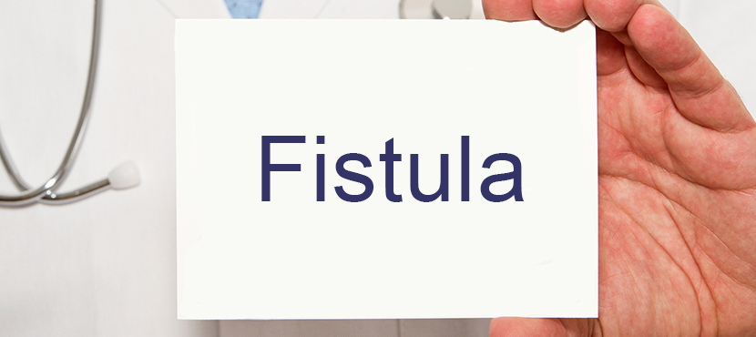 Fistel