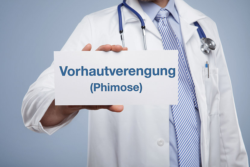 Phimose: Wann muss eine Vorhautverengung operiert werden? 