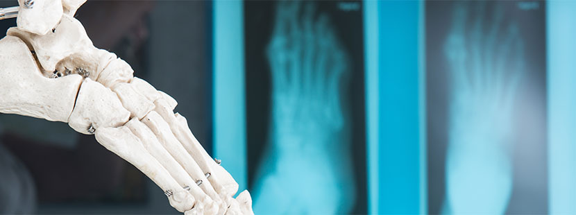 Röntgenaufnahmen von einem Fuß, Modell von einem Fuß im Vodergrund. Orthopäde Wien.