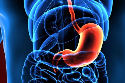 Magenkrebs Symptome, Ursachen, Anzeichen und Stadien: Ein rot unterlegter Magen in einem Menschmodell