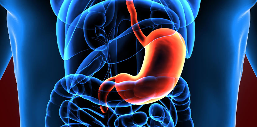 Magenkrebs Symptome, Ursachen, Anzeichen und Stadien: Ein rot unterlegter Magen in einem Menschmodell