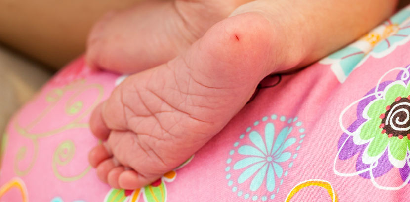 Phenylketonurie: Guthrie Test, Blutabnahme an der Ferse bei einem Baby