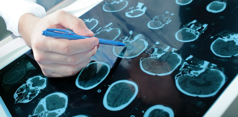 Neurologe Graz: Ein Arzt erklärt CT-Bilder.