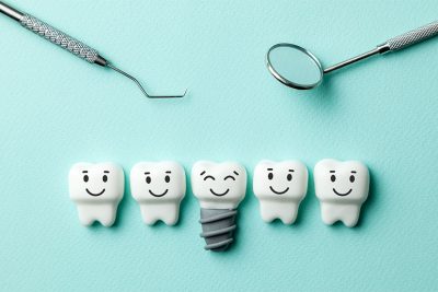 Vier normale Zähne und ein Implantat vor türkisem Hintergrund. Zahnimplantat Wien Kosten.