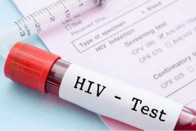 HIV Test Wien