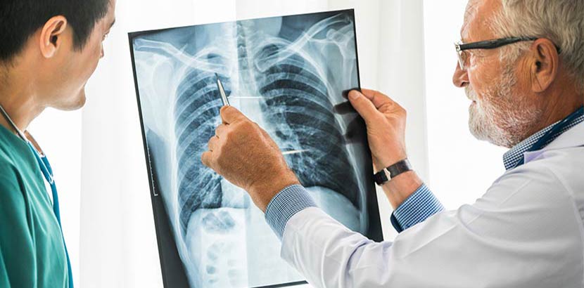 Älterer Lungenfacharzt, der ein Röntgenbild mit einem Patienten bespricht.
