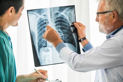 Älterer Lungenfacharzt, der ein Röntgenbild mit einem Patienten bespricht.