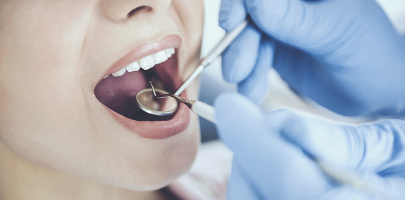 Ein Arzt verwendet eine Zahnsonde um den Mund einer Frau zu untersuchen.