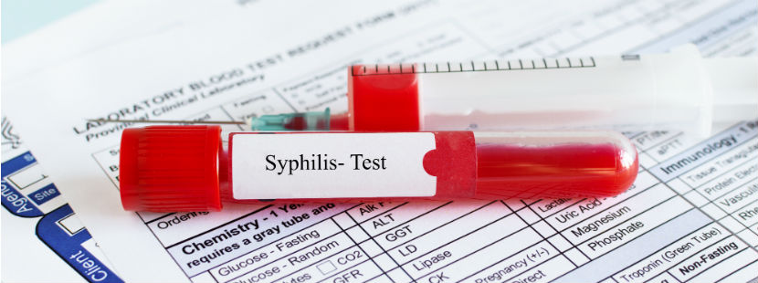 Syphilis Test: eine Blutprobe