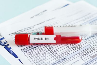 Syphilis Test: eine Blutprobe