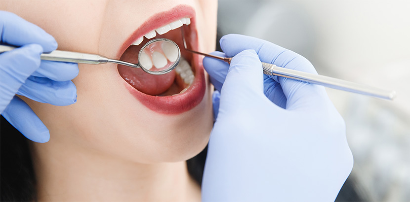 Ein Arzt verwendet Spiegel und Sonde bei der Vorbereitung für ein Zahn-Implantat.