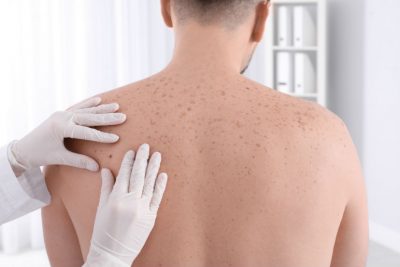 Hautarzt Linz: Ärztin untersucht Rücken eines Patienten.