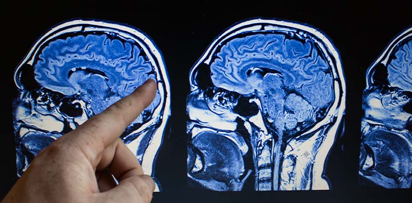 Daten und Informationen von Gehirn und Schädel bei CT.