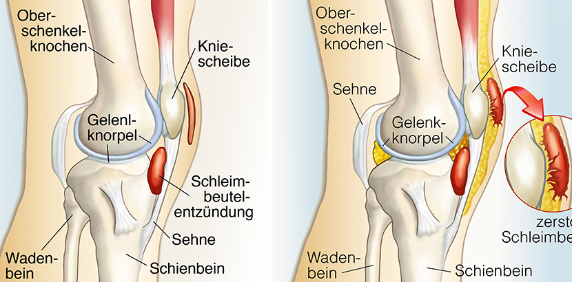 Kniespezialist Linz: Anatomische Zeichnung des Knies