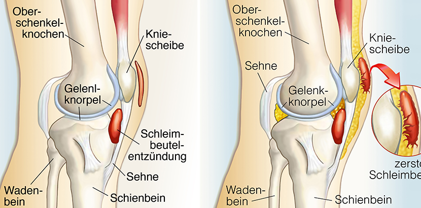 Kniespezialist Linz: Das sind unsere Empfehlungen! - Herold 