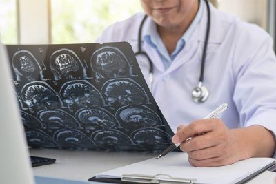 Fachärztin für Neurologie begutachtet Daten und Informationen von Hirn CT.