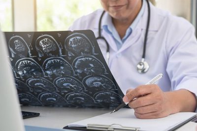 Fachärztin für Neurologie begutachtet Daten und Informationen von Hirn CT.