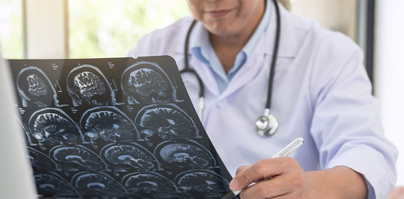Fachärztin für Neurologie begutachtet Daten und Informationen von Hirn CT.