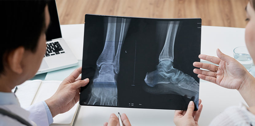 Sportarzt Graz sieht sich Röntgenaufnahme an