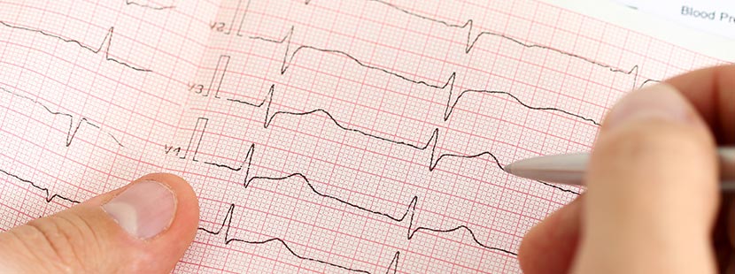 Arzt verwendet EKG-Daten und Informationen zur Diagnose einer Erkrankung.