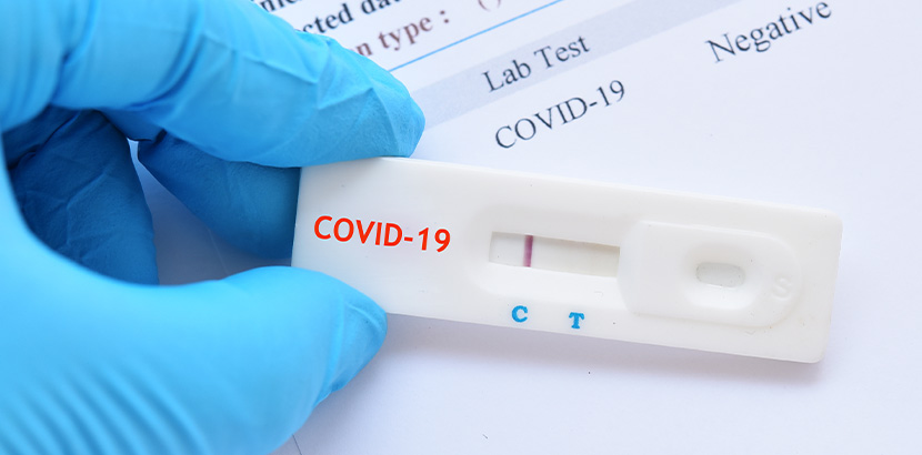 Arzt mit COVID-19 Testkassette nach Schnelltest durch Nasenabstrich.